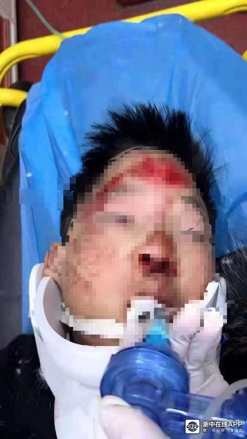 小孩被撞视频,路人紧急施救